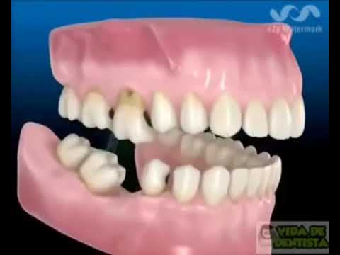 Видео о стоматологии