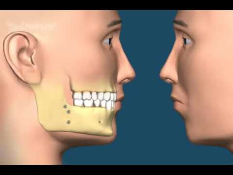 Видео о стоматологии