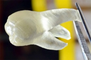 3D-напечатанные зубы, убивающие бактерии
