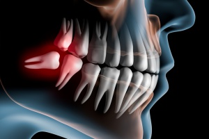 Ученые допустили регенерацию зубов у взрослых людей