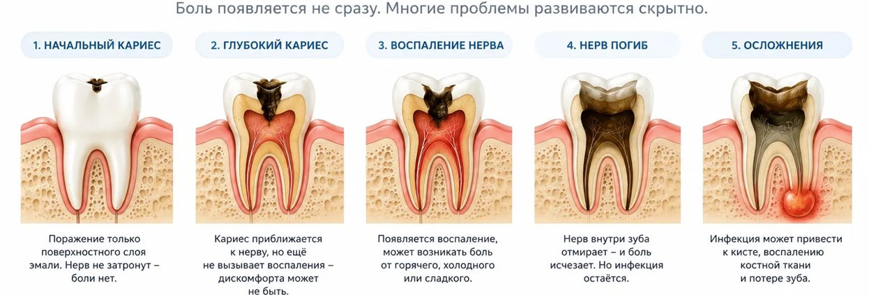 Почему зуб не болит, хотя проблема уже серьезная?