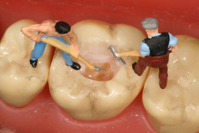 Модели зубов с маленькими человечками