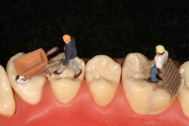 Модели зубов с маленькими человечками