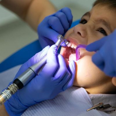 Профессиональная чистка зубов у детей